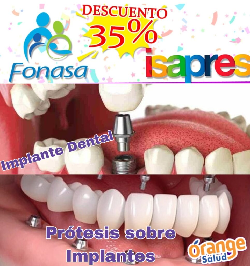 implantes-dentales01