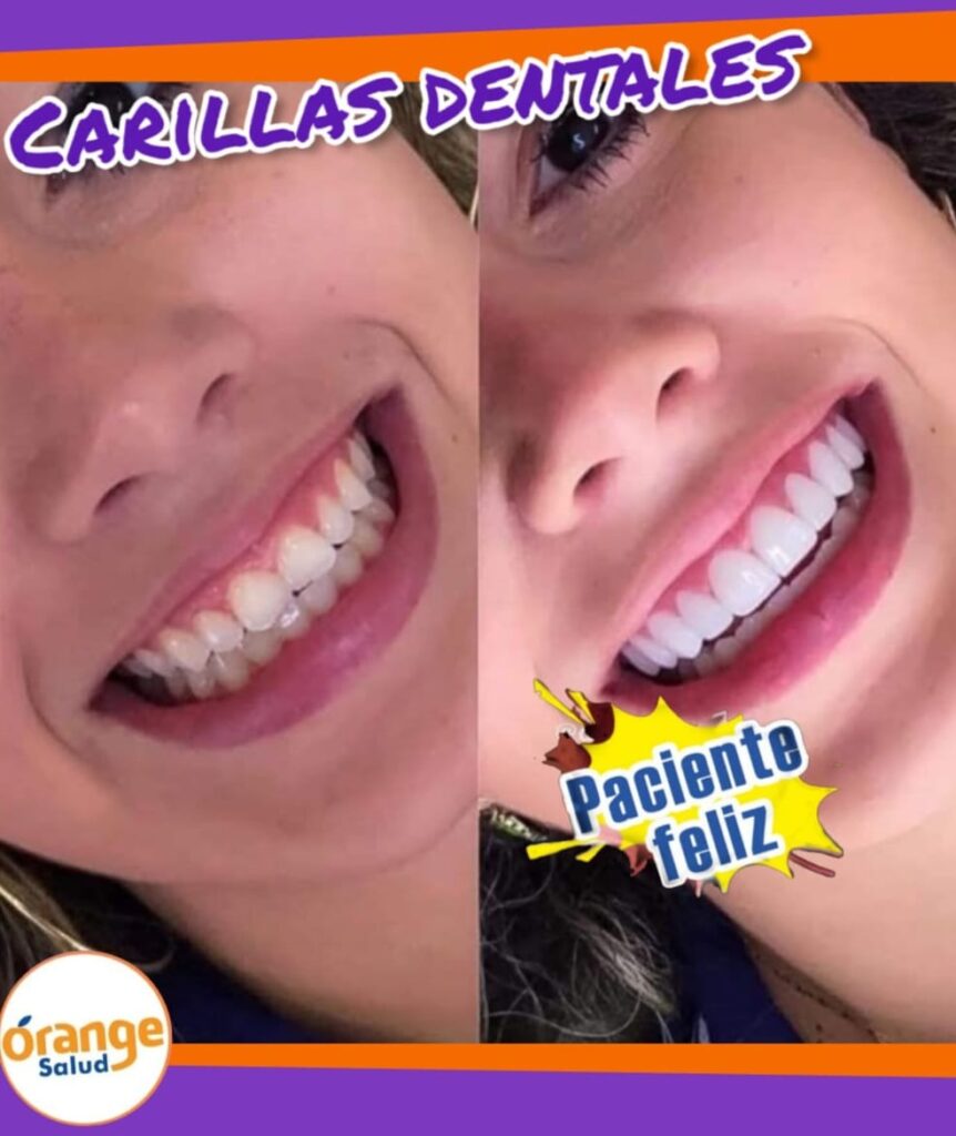 diseno2