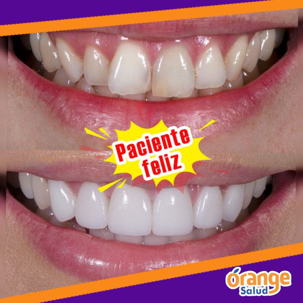 diseno3
