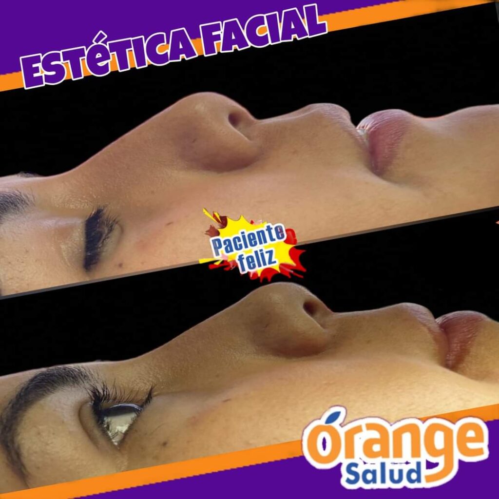 estetica-facial-01