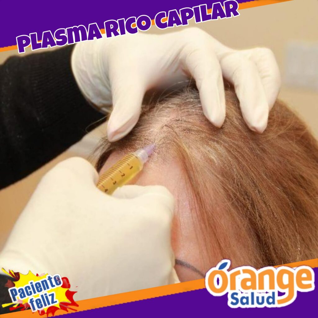 plasma-capilar