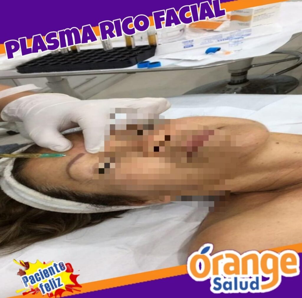 plasma-facial