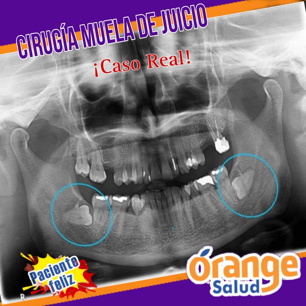 testimonio-radiografia
