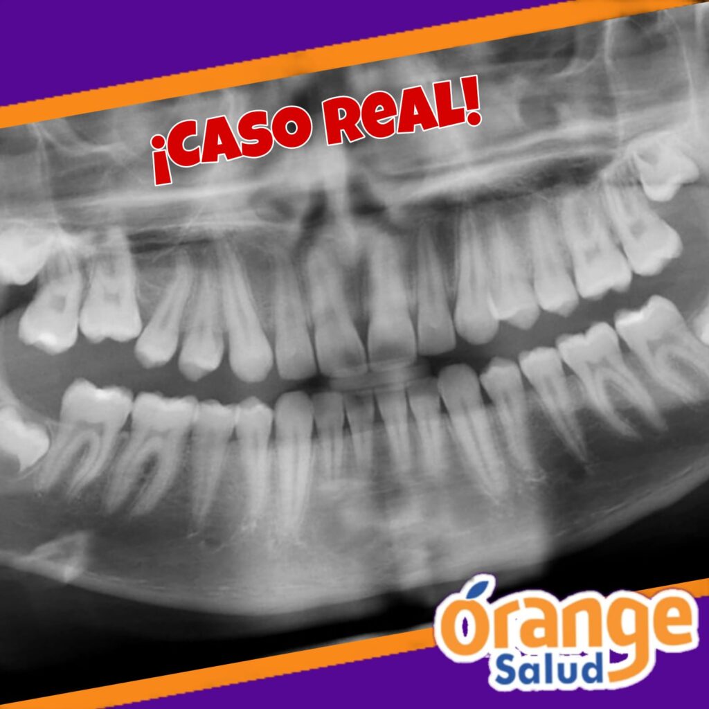 testimonio-radiografia1