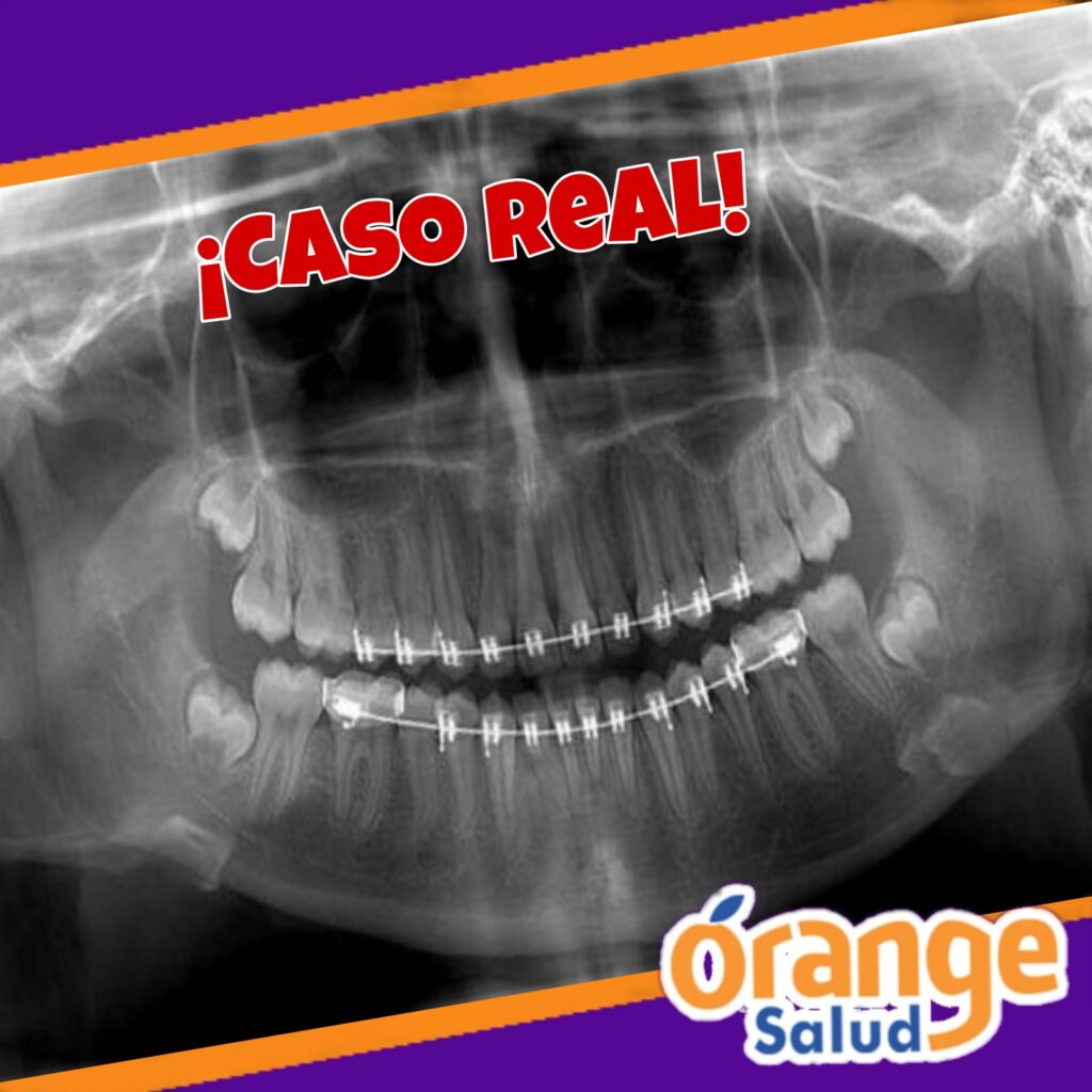 testimonio-radiografia2
