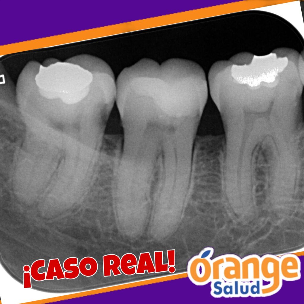 testimonio-radiografia3