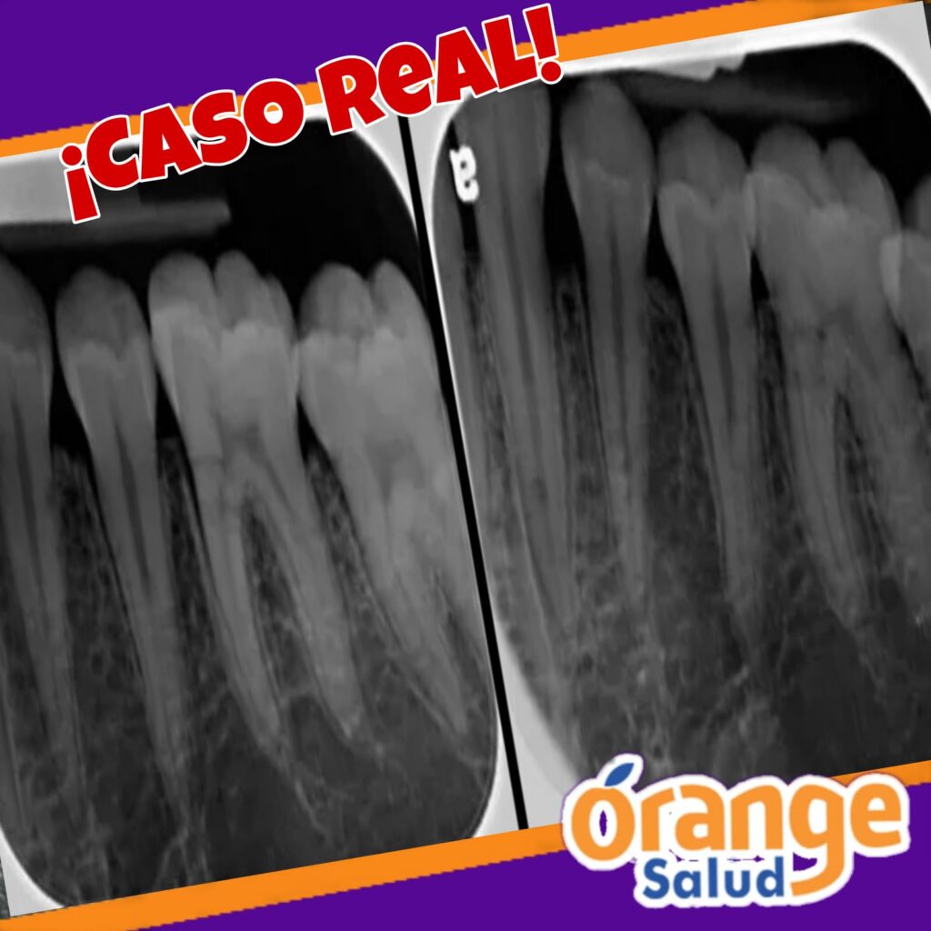 testimonio-radiografia4